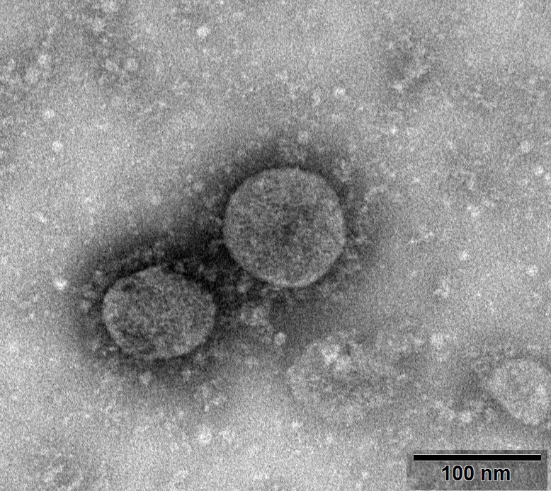 Koronavirüs fotoğrafı